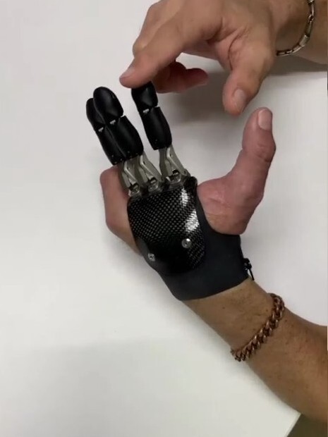 GripLock GripLock・義手・義指