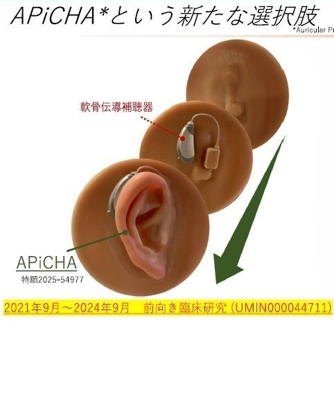日本重度四肢外傷シンポジウム 小耳症・義耳・APiCHA・軟骨伝導補聴器